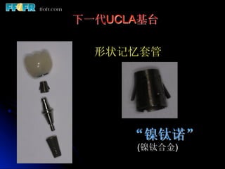 下一代UCLA基台

  形状记忆套管




      “镍钛诺”
      (镍钛合金)
 