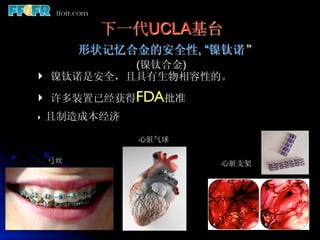 下一代UCLA基台
          形状记忆合金的安全性, “镍钛诺”
             (镍钛合金)
‣    镍钛诺是安全，且具有生物相容性的。

‣  许多装置已经获得FDA批准
‣    且制造成本经济

               心脏气球

     弓丝                心脏支架
 