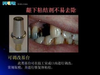 龈下粘结剂不易去除




可调改基台
   此类基台可在技工室或口内进行调改。
常规取模，并进行修复体粘结。
 