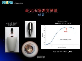 最大压缩强度测量
             结果
                        最大基台强度
在基台种植体界             *RODO装置并未发生破坏
 面发生破坏



                              750 N




                   传统基台破坏 800 ~ 1,000 N


            螺丝折断
 