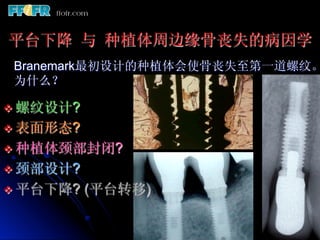 平台下降 与 种植体周边缘骨丧失的病因学
 Branemark最初设计的种植体会使骨丧失至第一道螺纹。
 为什么？

v  螺纹设计?
v  表面形态?
v  种植体颈部封闭?
v  颈部设计?
v  平台下降?   (平台转移)
 