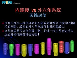 内连接 vs 外六角系统
           圆锥封闭
v  所有的基台—种植体界面在随载荷时都会出现10-50微
   米的间隙。最初的外六角系统弯曲时间隙最大。
v  这些间隙是否会存留微生物，并进一步引发炎症反应，
   造成种植体颈部骨丧失呢?
 