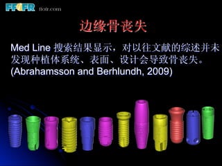 边缘骨丧失
Med Line 搜索结果显示，对以往文献的综述并未
发现种植体系统、表面、设计会导致骨丧失。
(Abrahamsson and Berhlundh, 2009)
 