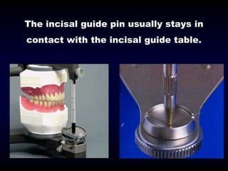 09- Occlusion in prosthodontics- occlusal correction.ppt