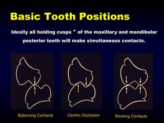 09- Occlusion in prosthodontics- occlusal correction.ppt