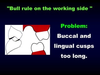 09- Occlusion in prosthodontics- occlusal correction.ppt