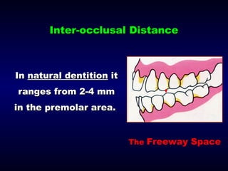 8- Occlusal Relationships for Removable Partial Dentures | PPT