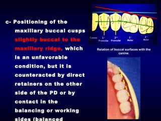 8- Occlusal Relationships for Removable Partial Dentures | PPT