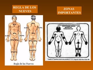 REGLA DE LOS      ZONAS
   NUEVES      IMPORTANTES
 