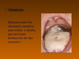 • Químicas:


 Incluyen todos los
 elementos causticos
 sean ícidos o alcalis,
 que provocan
 destrucción de tipo
 corrosivo
 