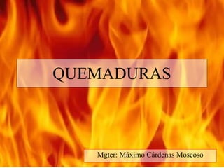 QUEMADURAS



   Mgter: Máximo Cárdenas Moscoso
 