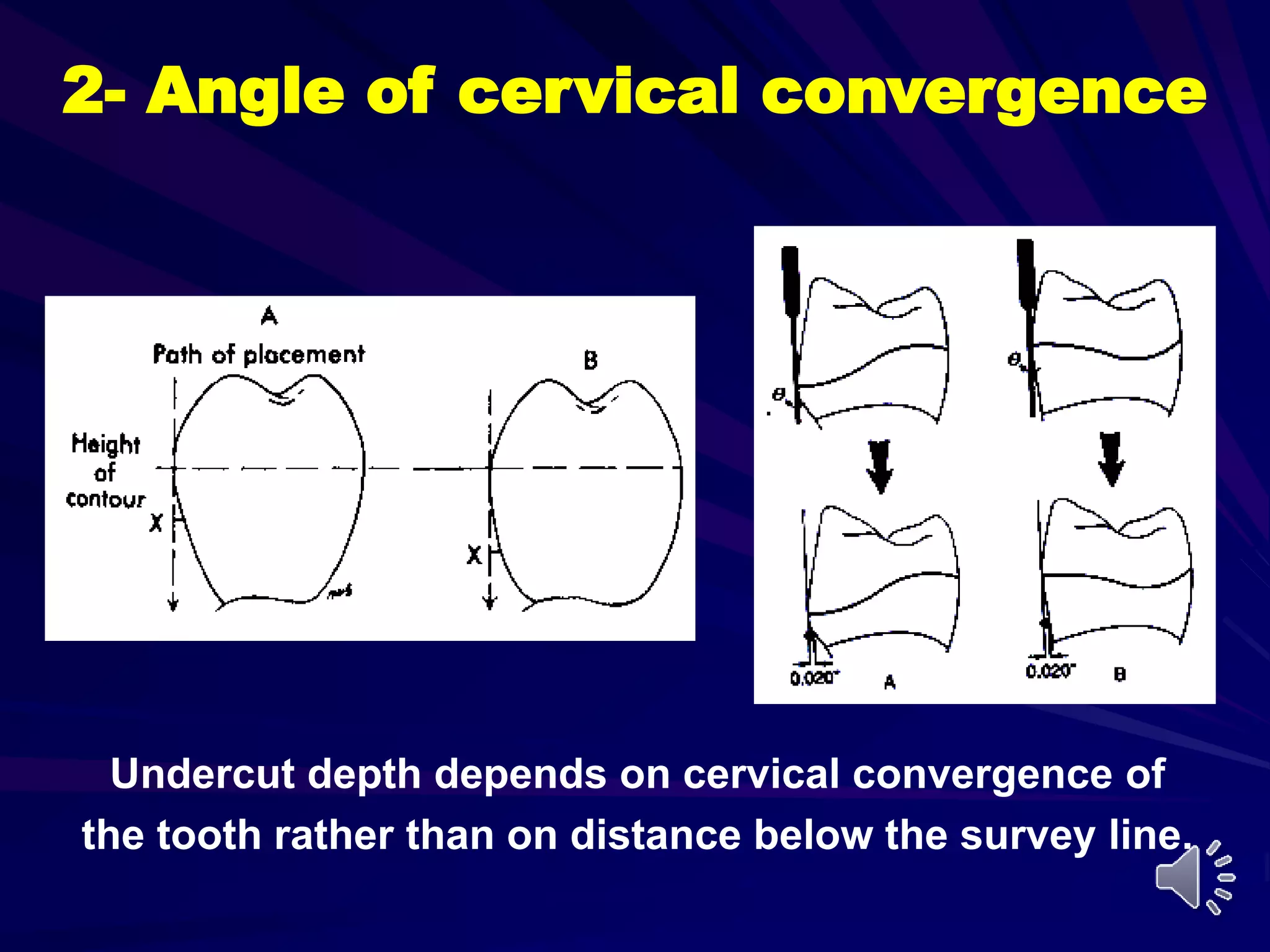 Direct Retainers of RPDs | PPT