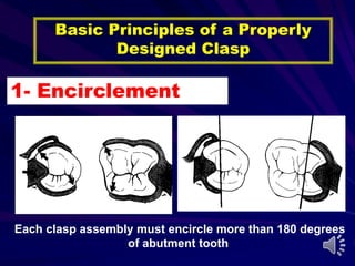 Direct Retainers of RPDs | PPT