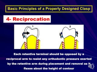 Holding Rpd Retainer Direct Retainers of RPDs | PPT