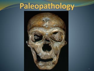 Paleopathology
1
 