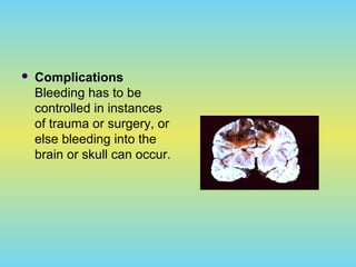  Complications
Bleeding has to be
controlled in instances
of trauma or surgery, or
else bleeding into the
brain or skull can occur.
 