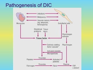 Pathogenesis of DIC
 