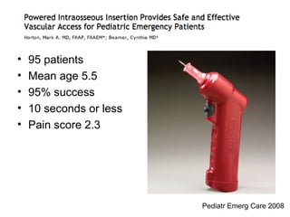 •   95 patients
•   Mean age 5.5
•   95% success
•   10 seconds or less
•   Pain score 2.3




                         Pediatr Emerg Care 2008
 
