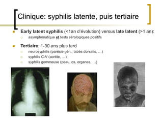 Clinique: syphilis latente, puis tertiaire
 Early latent syphilis (<1an d’évolution) versus late latent (>1 an):
 asymptomatique et tests sérologiques positifs
 Tertiaire: 1-30 ans plus tard
 neurosyphilis (parésie gén., tabès dorsalis, …)
 syphilis C-V (aortite, …)
 syphilis gommeuse (peau, os, organes, …)
 