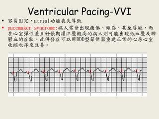 Ventricular Pacing-VVI
 容易固定，atrial功能喪失導致
 pacemaker syndrome:病人常會出現疲倦、頭昏、甚至昏厥，而
在心室彈性差且舒張期灌注壓較高的病人則可能出現低血壓及肺
鬱血的症狀。此併發症可以用DDD型節律器重建正常的心房心室
收縮次序來改善。
 