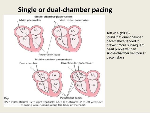 Single chamber pacemaker indications