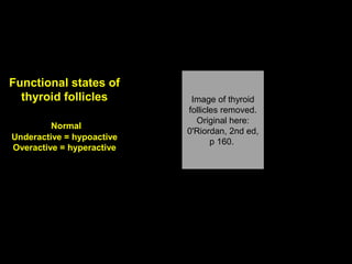 Functional states of
thyroid follicles
Normal
Underactive = hypoactive
Overactive = hyperactive
Normal
Image of thyroid
follicles removed.
Original here:
0'Riordan, 2nd ed,
p 160.
Aug 26, 2013 Umar Ahmad 58
 