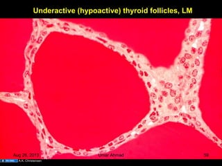Underactive (hypoactive) thyroid follicles, LM
A.K. Christensen
Aug 26, 2013 Umar Ahmad 59
 