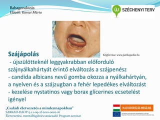 Babagondozás 
Előadó: Karsai Márta 
Szájápolás 
- újszülötteknél leggyakrabban előforduló 
szájnyálkahártyát érintő elváltozás a szájpenész 
- candida albicans nevű gomba okozza a nyálkahártyán, 
a nyelven és a szájzugban a fehér lepedékes elváltozást 
- kezelése nystatinos vagy borax glícerines ecsetelést 
igényel 
„Családi életvezetés a mindennapokban” 
SARKAD-DAOP-5.1.1-09-2f-2010-0002-16 
Életvezetési, mentálhigiénés tanácsadó Program sorozat 
Képforrása: www.patikapedia.hu 
 