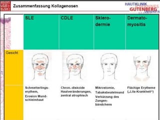 09.08 Bilder von Kollagenosen.Kollagenosen Mainz. Overlap Syndrom, Systemische Autoimmun- erkrankungen, Kollagenosen, Teil...