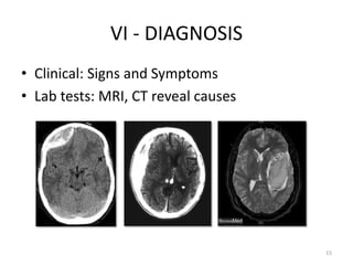 VI - DIAGNOSIS
• Clinical: Signs and Symptoms
• Lab tests: MRI, CT reveal causes




                                     15
 