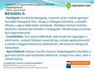 Csecsemő-és kisgyermekkori gyakran előforduló 
megbetegedések 
Előadó: Lupsán Zoltán 
Bőrkiütés II. 
- Pemfigoid: Fertőző bőrbetegség, melynek során a bőrön gennyes 
bennékű hólyagokat látni. Ahogy a hólyagok kiürülnek, a váladék 
kifolyik, s egyre több kiütés keletkezik. Általában kórházi fertőzés, 
alkoholos vattával kell letörölni a hólyagokat. Mindenképp orvosnak 
kell megmutatnunk! 
- Csalánkiütés: Test szerte előforduló, akár tenyérnyi nagyságot is 
elérő vörös, viszkető foltokat nevezünk így, melyek egyik pillanatról 
a másikra megjelenhetnek és eltűnhetnek. Rendszerint allergia áll 
hátterében. 
- Apró kiütések: Sokszor banális hurutos megbetegedést követően a 
gyermek testén apró kiütéseket láthatunk, melyet vírus okoz, akár a 
náthát kísérve 
„Családi életvezetés a mindennapokban” 
SARKAD-DAOP-5.1.1-09-2f-2010-0002-16 
Életvezetési, mentálhigiénés tanácsadó Program sorozat 
 