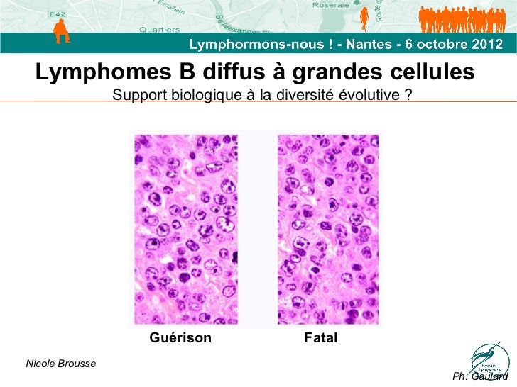Lymphome Cancer Du Systme Lymphatique Doctissimo Lymphome Cancer Du Systme Lymphatique Doctissimo