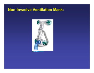 Non-invasive Ventilation Mask:




                ResMed
 