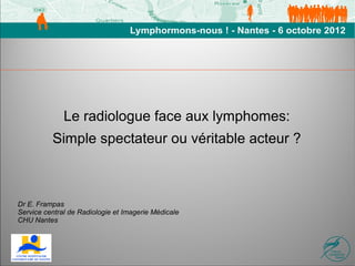 Le radiologue face aux lymphomes:
          Simple spectateur ou véritable acteur ?



Dr E. Frampas
Service central de Radiologie et Imagerie Médicale
CHU Nantes
 