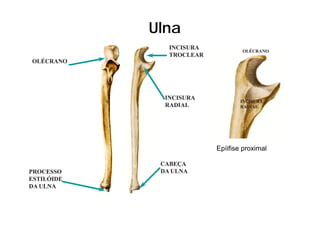 Ulna
               INCISURA
                                  OLÉCRANO
               TROCLEAR
OLÉCRANO




              INCISURA
                                  INCISURA
              RADIAL              RADIAL




                          Epíifise proximal

             CABEÇA
PROCESSO     DA ULNA
ESTILÓIDE
DA ULNA
 