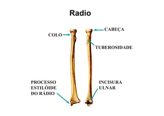 Radio
                       CABEÇA
                           Ç
      COLO

                     TUBEROSIDADE




PROCESSO              INCISURA
ESTILÓIDE             ULNAR
DO RÁDIO
 