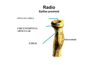 Radio
                  Epífise proximal

FÓVEA DA CABEÇA




CIRCUNFERÊNCIA
ARTICULAR


                                     Tuberosidade
          COLO
 
