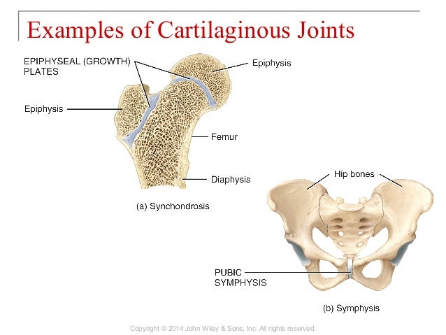 09 [chapter 9 joints]