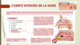 CUERPO EXTRAÑO EN LA NARIZ
 