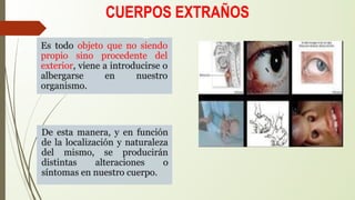 CUERPOS EXTRAÑOS
 