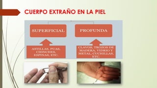 CUERPO EXTRAÑO EN LA PIEL
 