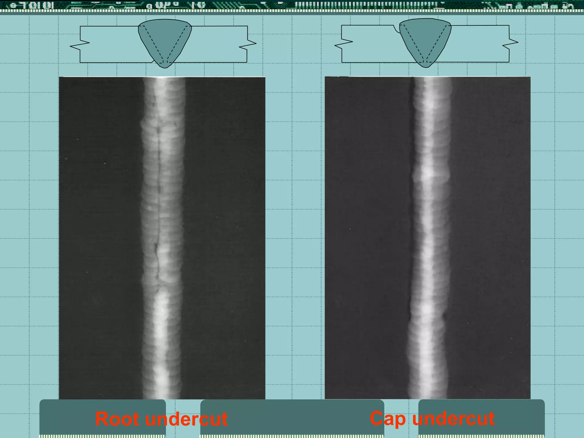 Cap undercut
Root undercut
 