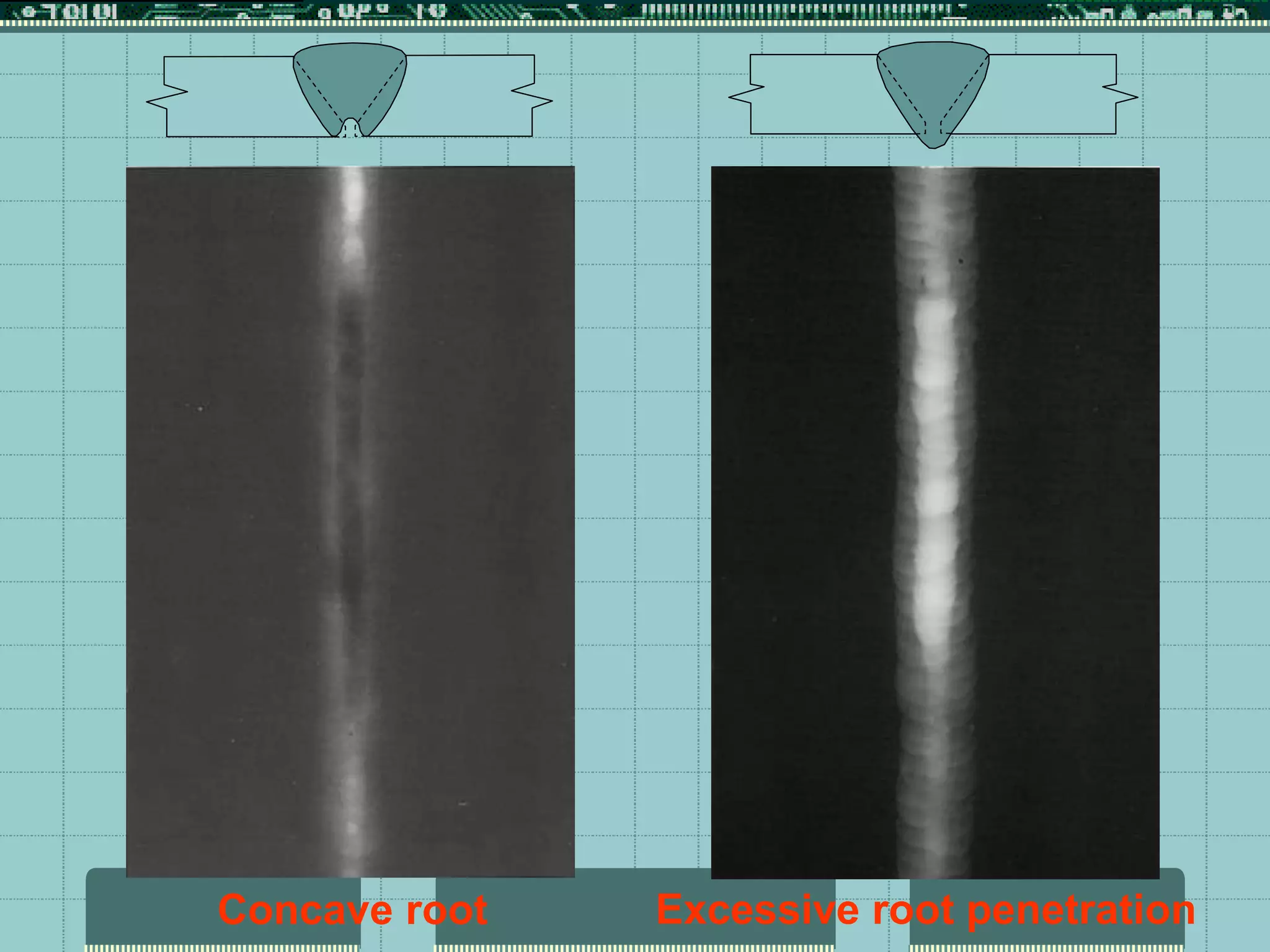 Concave root Excessive root penetration
 