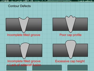 Contour Defects
Incomplete filled groove Poor cap profile
Excessive cap height
Incomplete filled groove
+ Lack of sidewall fusion
 
