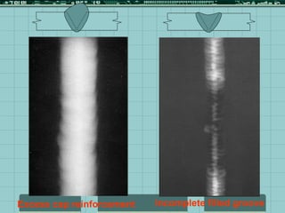 Incomplete filled groove
Excess cap reinforcement
 