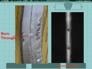 Burn through
Burn
Through
 