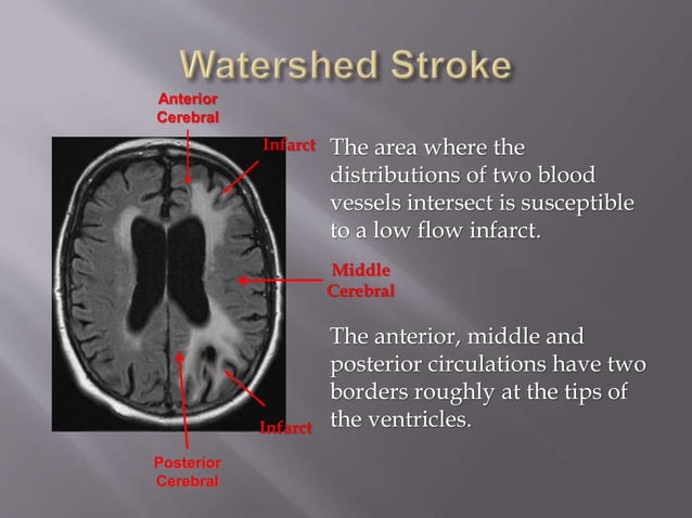 Pbo2 Licox Brain Ventriculostomies and Licox | PPT