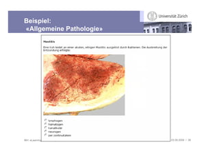 Beispiel:
«Allgemeine Pathologie»




IBH: eLearning Community Treffen   03.09.2009 / 38
 