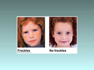 Freckles No freckles
 