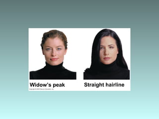 Widow’s peak Straight hairline
 